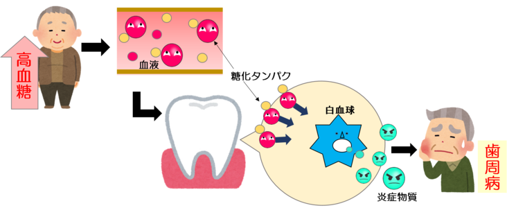 糖尿病が及ぼす影響についてのイラスト